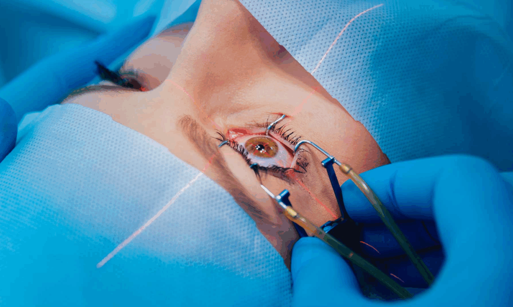 ai-driven-laser-eye-surgery:-how-blue-fin-vision-refines-outcomes-through-smart-surgical-planning
